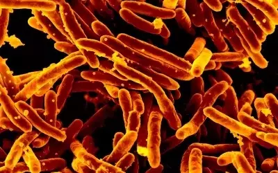 Revolutionizing Tuberculosis Diagnostics: A New Era of Swift and Accurate Detection