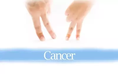 Inhibrx's Cancer Therapy Demonstrates High Efficacy in Head and Neck Cancer Trials