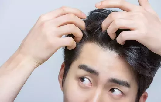탈모 증상과 치료 방법, 제대로 알아보기