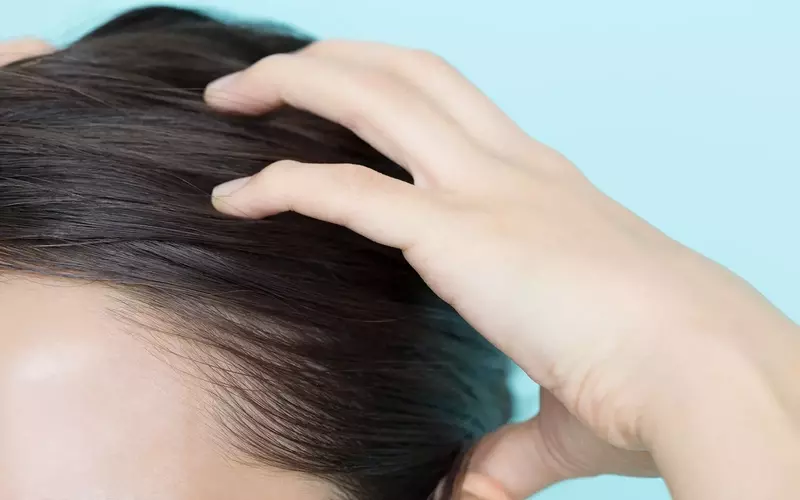지루성 피부염 치료, 제대로 알아보기: 증상부터 관리까지