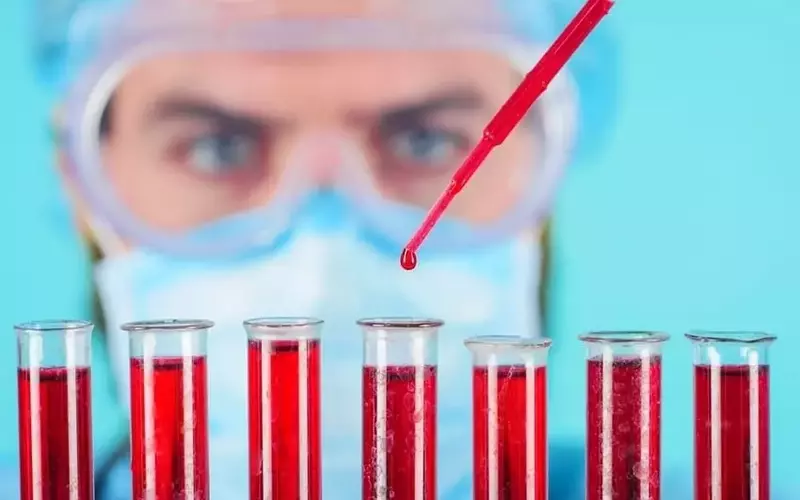 Immix Biopharma: Analyst Bullish but Flags Safety and Adoption Questions