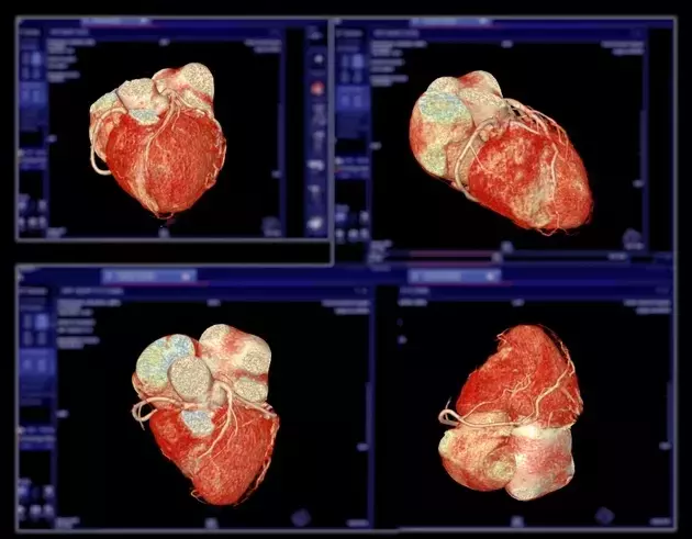 BioAge Labs: Advancing with BGE-102 in Cardiometabolic Therapies
